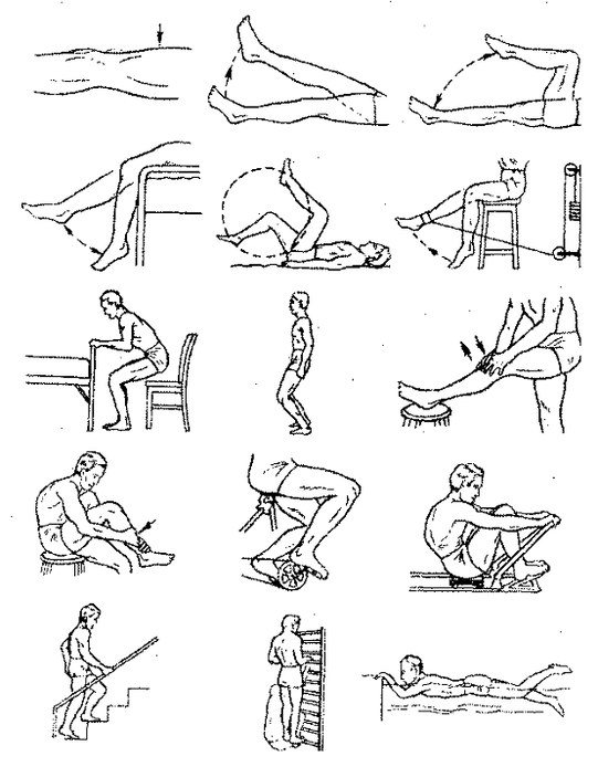 Therapeutic exercises on the arthrosis of the knee joint