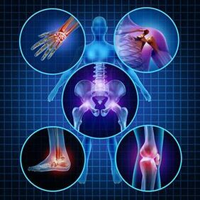 How to make the mobility of the joints easier with arthritis and osteoarthritis during treatment